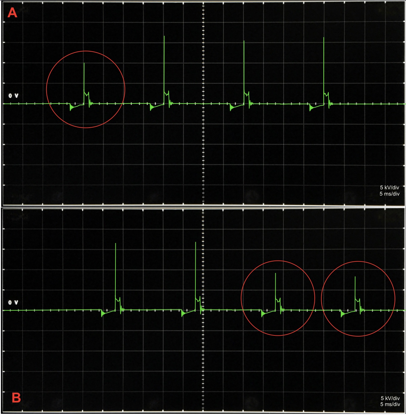 Oscylogram (A) przedstawia zbyt małą wartość impulsu wysokonapięciowego cewki 1-go cylindra spowodowany nieprawidłową przerwą na elektrodach świecy zapłonowej. Oscylogram (B) obrazuje zapis obniżonego napięcia dla cylindrów nr 2 i nr 4 